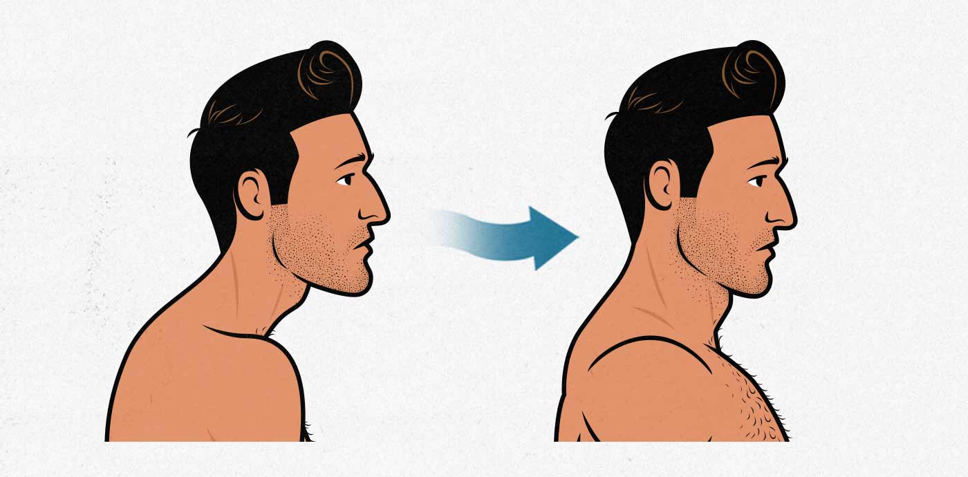 Head Forward (Tech Neck)