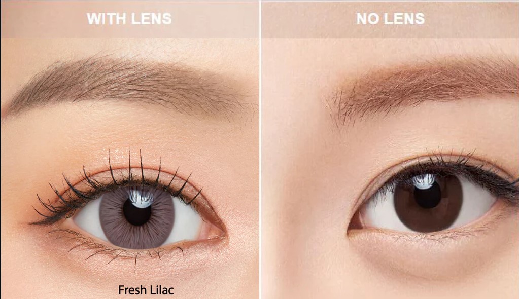ACUVUE