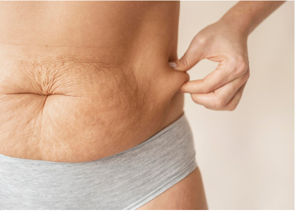 Abdominal